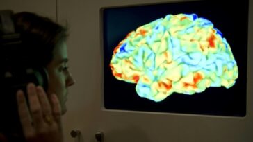 implante-cerebral-transforma-pensamentos-em-fala-quase-em-tempo-real