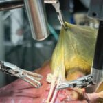 robo-realiza-primeira-cirurgia-realista-sem-auxilio-humano